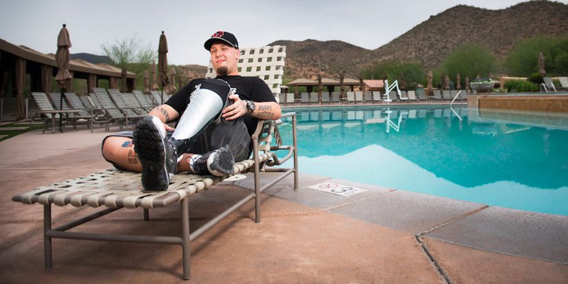 digitalization-prosthetics-recover